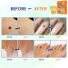 Advanced Skin Tag Remover Pads - Set of 42 Quality Orange Pads - Buy Online on GoSupps.com