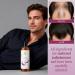 Shampooing Nourrissant Nettoyage Contr le Des Huiles Du Cuir Chevelu 236ml Shampooing L'Oignon Nettoyant Et Soin Capillaire Pour Femme Types De Cheveux Usage Quotidien Voyage Salon Ex - Buy Online on GoSupps.com