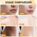 Bee Venom Comprehensive Cream Bee Venom Skin Treatment Cream Advanced Firming & Wrinkle-Reducing cream Natural Skin Moisturizer for All Skin Types(2PCS) - Buy Online on GoSupps.com