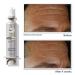 RoC Derm Correxion Fill + Treat Advanced Retinol Serum with Hyaluronic Acid - 15ml + Sample - Buy Online on GoSupps.com
