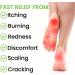SMOOTH AF Medicated Athlete's Foot Wipes - Fast Relief Antifungal Treatment with Tolnaftate 1% - 30 Count, Alcohol-Free, Clinically Proven, APMA Approved - Buy Online on GoSupps.com
