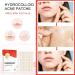 Hydrocolloid Acne Patches - 144 Invisible Spot Patches for Face & Body, 8mm & 12mm - Calms & Relieves Acne Quickly - Buy Online on GoSupps.com