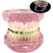 High-Quality Lhlyl-DP Dental Teeth Model for Orthodontic Brackets Simulation | Metal & Ceramic Self-Ligating Bracket Demonstration - Buy Online on GoSupps.com