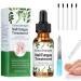 Fungal Nail Treatment Toenail Fungus Treatment Extra Strong Nail Repair Solution for Toenails & Fingernails Protects Thick Broken And Discolored Nails Restoring Healthy Nails 30ML Green-1