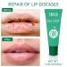 Yopela Lip Sunscreen Moisturizing and Repair Package SPF 30 - 9-Pack with 3 Flavors - Long Lasting Moisture and Lip Repair - Buy Online on GoSupps.com