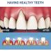 Dentiz Gum Therapy Gel & Tooth Whitening Set - 3-Piece Immediate Treatment for Stains & Cleaning - Buy Online on GoSupps.com