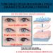 928 Count Eyelid Lifter Strips for Heavy Hooded Lids - Instant Eye Lift Without Surgery - Perfect for Uneven Mono-Eyelids - 928Pcs - Buy Online on GoSupps.com