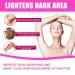 Dark Spot Remover & Skin Lightening Cream - Brightening Treatment for Face & Body | Freckle & Hyperpigmentation Corrector - 0.71oz - Buy Online on GoSupps.com