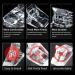 10PCS Nail Tips Clip - Quick Extension Clamp for Nail Forms - Transparent UV LED Builder Clamps for DIY Manicure - Buy Online on GoSupps.com