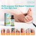 2025 Nail Repair Solution for Toenail Fungus | Extra Strength Fungal Nail Treatment | Restore Discolored Nails - Buy Online on GoSupps.com