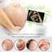 Stretch Mark Cream - Body Skin Care - Body Oil for Women - Firming & Lifting Body Oil - Stretch Marks Removal Skin Care Oil - Improves the Appearance of Stretch Marks Restore Skin Elasticity Body Oil - Buy Online on GoSupps.com