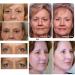 Openeyes Awaken Peptide Lifting Eye Gel for Women and Men - Dark Circles & Puffiness - 2pcs - Buy Online on GoSupps.com