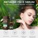 Spot Treatment - Acne Treatment - Face Serum for Women - Tea Tree Oil Serum Face - Dark Spot Correcting Glow Serum Remover for Face - Hydrating Face Serum - Fade Acne Mark 60ml - Buy Online on GoSupps.com