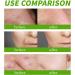 Nmbol Cream Instant Anti-wrinkle WL 1 - Buy Online on GoSupps.com
