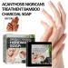Klarime Soap Klarime Savon au Charbon de Bambou Naturel Charbon de Bambou Savon Fait Main Visage et Corps D tachant pour le Nettoyage du Visage et du Corps 2pcs - Buy Online on GoSupps.com