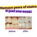 BURST Teeth Whitening Strips with Coconut Oil - Gentle, Enamel Safe, Fast Results - 7 Treatments - Buy Online on GoSupps.com