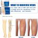 Traitement des varices pour les jambes la cr me de varices de jambe Varicose soulager l'enflure et la lourdeur 50g / 1 76fl.oz (1pcs) - Buy Online on GoSupps.com