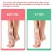 Buy Tachibelle Callus Remover ULTRA Scent - Professional Dead Skin Eliminator for Feet (8 oz) | Fast International Shipping - Buy Online on GoSupps.com