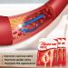 Spider Vein Plaster 30ct | Varicose Vein & Phlebitis Care | Leg Vein Removal Treatment - Buy Online on GoSupps.com
