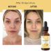 Relaxcation Pure Elemi Oil - Steam Distilled Natural Oil for Face Hair Nails & Body | Aromatic Extract for Diffuser Massage Skin Care & Cuticles | Vegan Organic Travel Size (4 oz) 4 Fl Oz (Pack of 1) - Buy Online on GoSupps.com