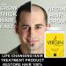Virgin Hairgrow UK - No.1 Hair Loss & Baldness Treatment Pill | Shop Internationally - Buy Online on GoSupps.com