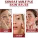 Skynpure - Pure Collagen Mask Le Masque au collag ne r duit Les ridules et Les Rides du Front et des Joues 1pcs - Buy Online on GoSupps.com