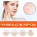 Fast-Acting Hydrocolloid Acne Patches | 72 Invisible Stickers for All Acne Types | Covers Pimples Hides Spots & Removes Oil - Shop Now - Buy Online on GoSupps.com