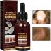  Raxove Coconut Hair Growth Oil Natural Hair Regrowth Oil 30ml for Women Men - Nutrition Hair Products to Improve Hair Health - Buy Online on GoSupps.com