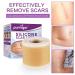 Silicone Scar Tape Roll 1.6 x 60 - Medical Tape for Surgical Scars, Keloid, C-Section, Burns, Injuries - Stretch Marks Removal & Wound Care Bandages - Buy Online on GoSupps.com