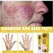 VEJIA Eczema Psoriasis Treatment Cream 20g - Dermatitis Pruritus Relief Ointment for Adults (3pcs) - Buy Online on GoSupps.com