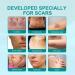Scar Removal Spray - 2pcs Stretch Mark Remover 20g Gentle Skin Care - Buy Online on GoSupps.com