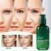 Hyaluronic Acid Facial Serum Hyaluronic Acid Serum Anti Wrinkle Serum Dark Spot Remover for Face Hyaluronic Acid Face Serum for Women Face Moisturiser Skin Tightening Hydrating Plump Skin - Buy Online on GoSupps.com