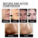 FFEEJ Men's Daily Facial Cleanser - Deep Cleansing Oil Control Brightening & Tightening Pores - Buy Online on GoSupps.com
