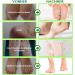 P-Beauty Footmaster Aloe - Intensive Foot Care Peeling Socks | Remove Rough Skin Cracks & Calluses | 5 Pairs for Silky Soft Feet - Buy Online on GoSupps.com