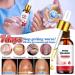 Fungal Nail Treatment for Toenail Toe Nail Fungal Treatment Anti Fungus Nail Repair and Strengthen Toenail Fungus Treatment Fungal Nail Drop Fix and Renew Damaged Cure Nail Fungus Restoring Nails - Buy Online on GoSupps.com