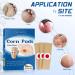 Corn Remover Pads Wart Remover Foot Corn Remover Patch 24 Pcs Corn Removal Pads Corn Removal Ideal for Relief Corn Pain and Foot Care Corn Plasters with Hole for Feet Hand Toe - Buy Online on GoSupps.com