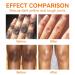 Dark Spot Corrector Cream - Underarm Knee Elbow & Intimate Skin Treatment - 4.21oz - Buy Online on GoSupps.com