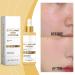 Exfoliating Rice Ampoule Rice Serum for Gentle Face Peel Dead Skin Remover Pore Minimizing & Deep Hydration Exfoliant with Hyaluronic Acid for Glowing Skin All Skin Types (White Rice 30ml) White Rice 1 Fl Oz (Pack of 1) - Buy Online on GoSupps.com