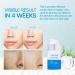 Retinol Eye Stick & Dark Spot Corrector Serum - Powerful formula for brightening and rejuvenating under-eye area - Buy Online on GoSupps.com