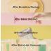 YNOTCARE Ingrown Hair Serum - Prevent Ingrown Hair & Razor Bumps in Bikini Area | Soothe Irritation | 1.69oz - Buy Online on GoSupps.com