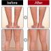 Cr me pour les varices cr me contre les varicosit s soin doux des jambes pour une bonne sensation dans les jambes pommade de soin des jambes am liore la circulation sanguine pour les jambes - Buy Online on GoSupps.com