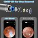 Jaydear Wireless Otoscope Ear Cleaner & Camera Kit | 1920P FHD | USB Charging | LED Lights | Ear Wax Removal for iPhone & Android | Black - Buy Online on GoSupps.com