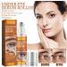 Under Eye Roller for Dark Circles and Puffiness Retinol Eye Cream Eye Cream Roller Reduce Wrinkles and Fine Lines Hydrating Under Eye Cream Relax Eyes Fatigue - Buy Online on GoSupps.com