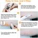 Electronic Bug Bite Itch Relief Pen for Kids & Adults - Chemical-Free Insect Sting Swelling Healer & Skin Itchless Reliever - Buy Online on GoSupps.com