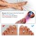 Ikeen Nail Fungus Treatment Device - Effective Onychomycosis Relief with Red & Blue Light Painless & Fast Fuzspilz Solution for Healthy Nails - Buy Online on GoSupps.com
