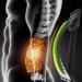 Verdant Touch Back Massage Device - Adjustable Lumbar Cracker Stretcher | 4-Level Spine Deck in Green & Black for Ultimate Back Pain Relief - Buy Online on GoSupps.com