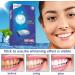 Advanced No-Slip Teeth Whitening Strips | Brighten Yellow & Stained Teeth Fast - Buy Online on GoSupps.com