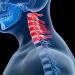 Hang Mat for Neck Pain Relief | Cervical Traction Device for Muscle Relaxation & Spine Alignment | Improve Sleep at Home - Buy Online on GoSupps.com