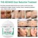 Scar Cream for Old Scars & Stretch Marks - 1.7 fl. oz Gel Treatment for Surgical Scars, Burns, Acne - Men & Women Repair Skin - Buy Online on GoSupps.com
