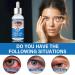 Stye Eye Treatment Serum for Chalazion & Blepharitis | Gentle Eye Cleanser & Health Booster | 1 Fl. oz - Buy Online on GoSupps.com
